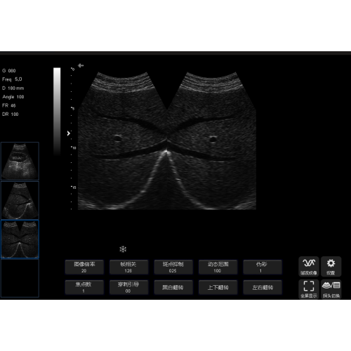 Sonostar SS-6B Ultrasound Machine meilleure que SS-7